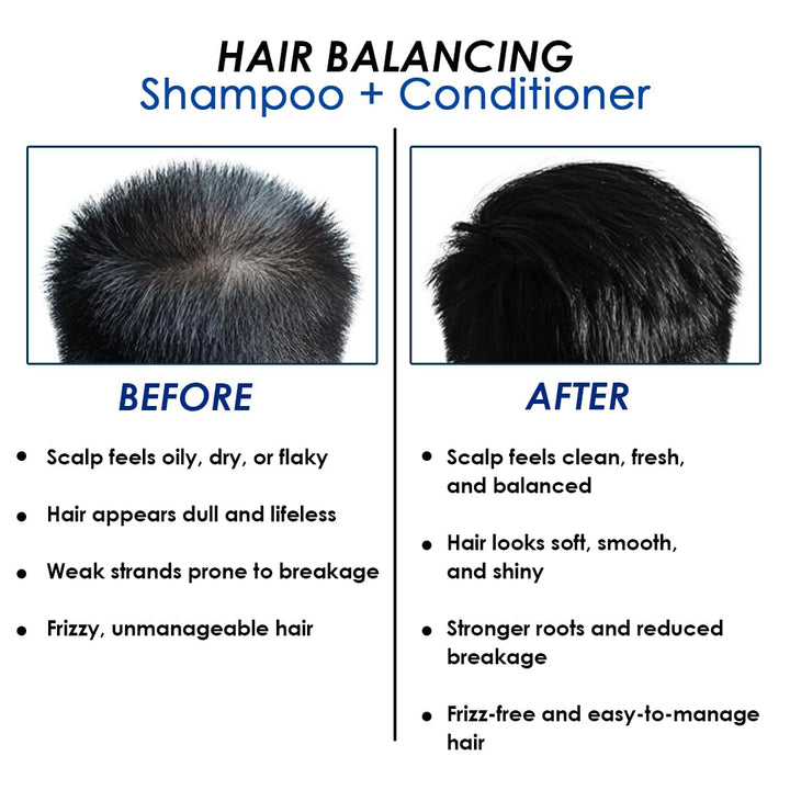 Hair Balancing Shampoo + Conditioner 400ml – 2-in-1 Formula with 10% Niacinamide for Oily Scalp Control, Dandruff Reduction & Stronger Hair