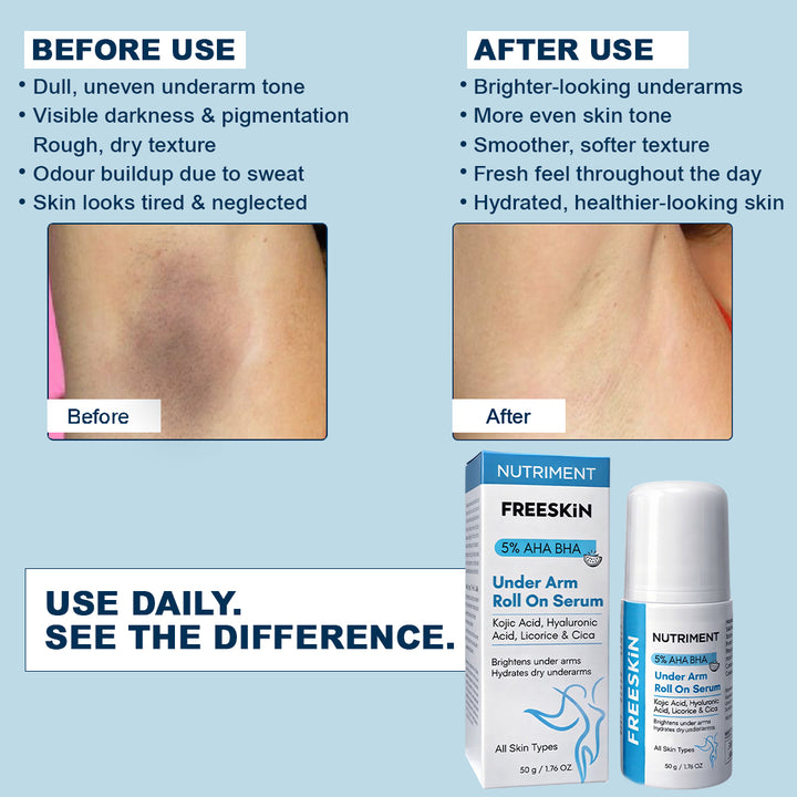 5% AHA BHA Underarm Roll On Serum 50g |  Brightening, Dark Spot Reduction & Odour Control