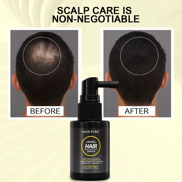 Hair Growth Serum 30 ml | Hair Fall Preventing Serum Containing Redensyl, Procapil, Anagain for Healthier Hair Roots