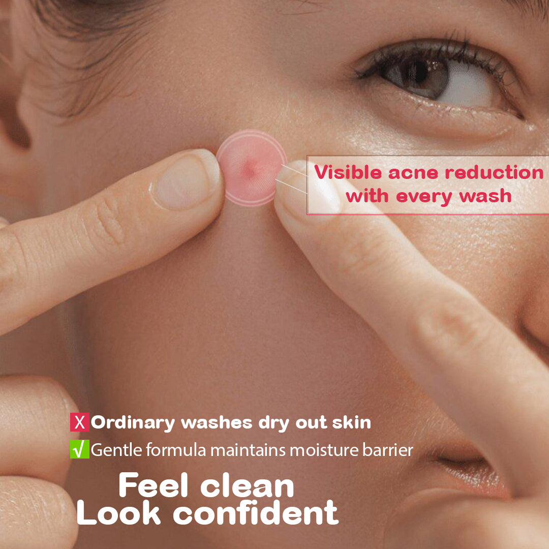Niacinamide 5% Face Wash 100ml | Pore Refining & Oil Control Cleanser | Brightening Anti-Acne Facewash with Zinc PCA & Witch Hazel