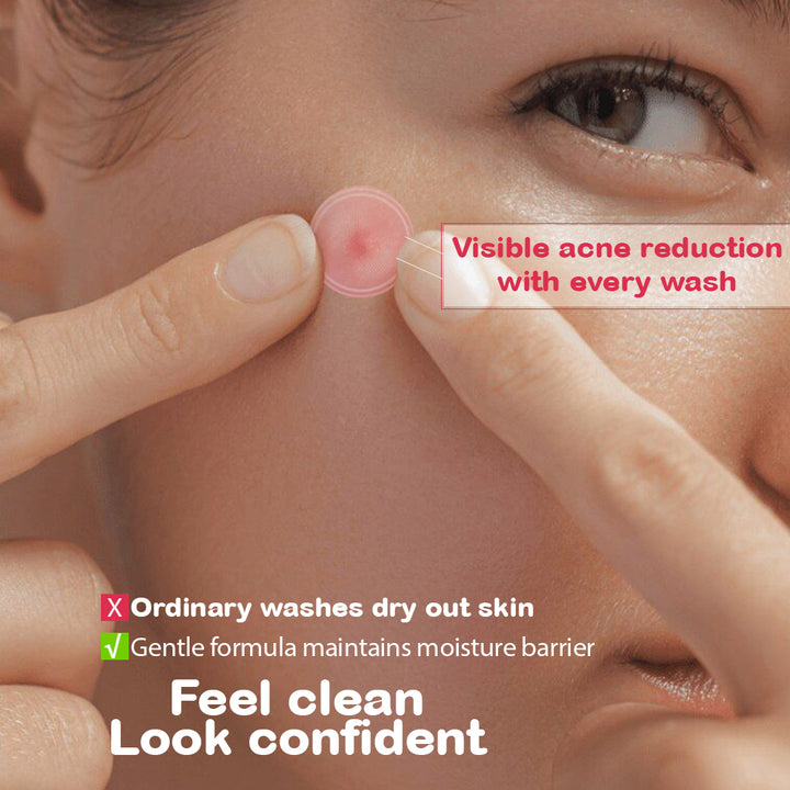 Niacinamide 5% Face Wash 100ml | Pore Refining & Oil Control Cleanser | Brightening Anti-Acne Facewash with Zinc PCA & Witch Hazel