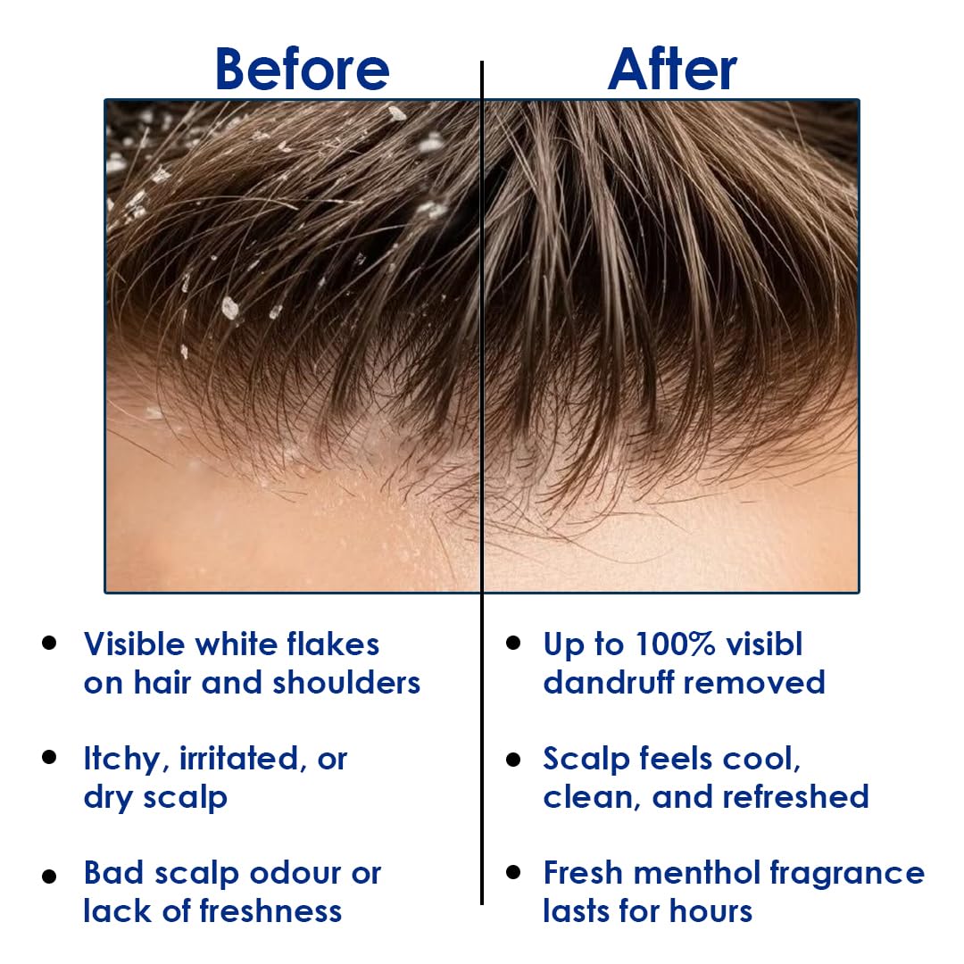 Anti-Dandruff Shampoo (400ml) | Zinc Pyrithione & Menthol Cooling Formula for Men – Fights Dandruff, Cleanses Scalp & Strengthens Hair