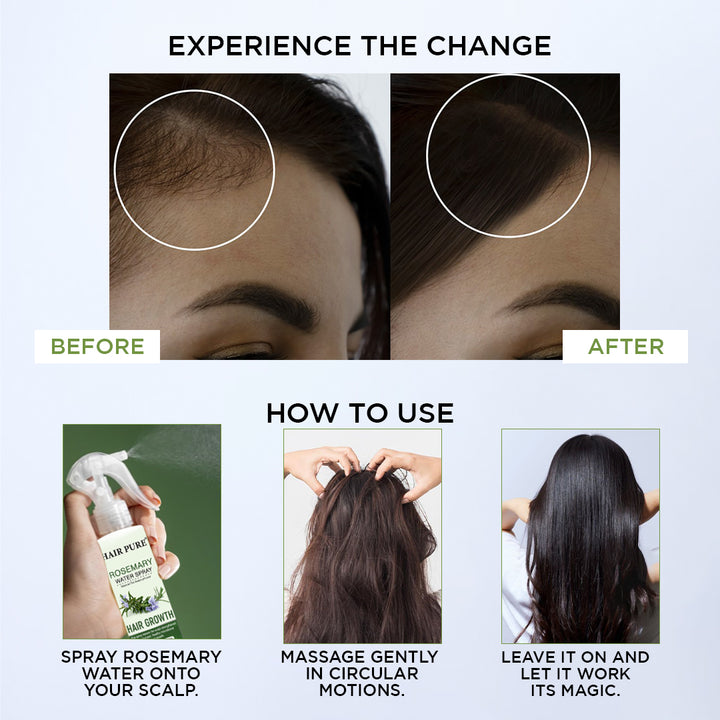 Rosemary Water Spray 100ml | Hair Growth & Anti Hair Fall Spray