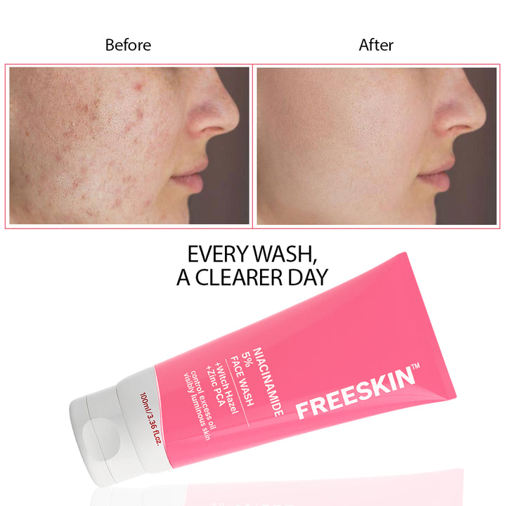 Niacinamide 5% Face Wash 100ml | Pore Refining & Oil Control Cleanser | Brightening Anti-Acne Facewash with Zinc PCA & Witch Hazel