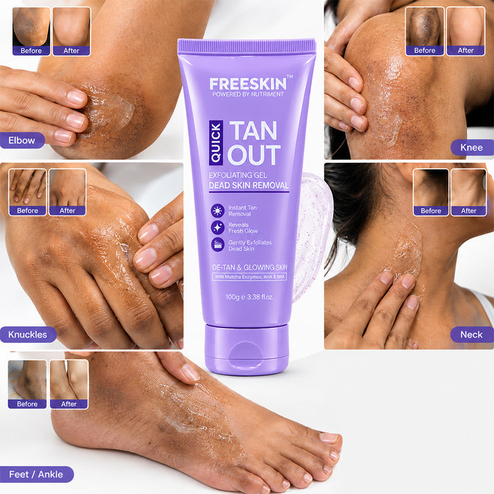 Quick Tan Out Exfoliating Gel for Face & Body, 100g | Dead Skin Cell Removal & Tan Removal Gel